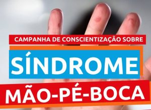 Síndrome mão e pé