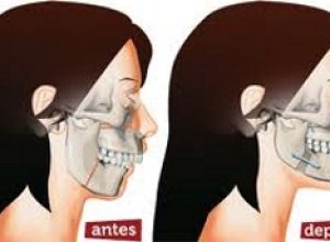 cirurgia odontologica